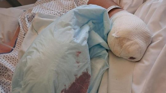 Chwila nieuwagi, która zmieniła wszystko. Dramatyczny apel rodziców po nocy sylwestrowej w Jastrowiu